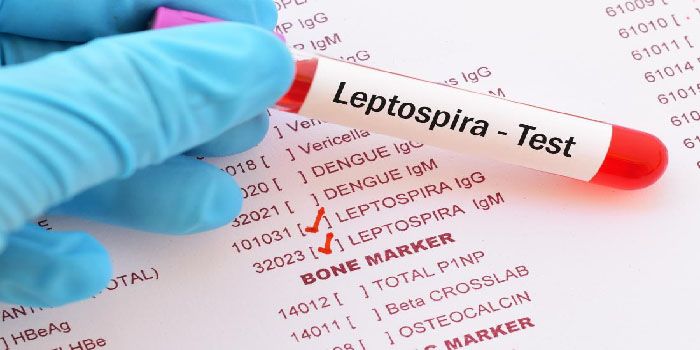 Angka Kematian Akibat Penyakit Leptospirosis Meningkat, Pemerintah Kota Yogyakarta Galakkan Pembersihan Lingkungan