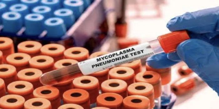 Sejumlah Anak di Jakarta Terpapar Mycoplasma Pneumonia, Kemenkes Siapkan Jejaring Laboratorium