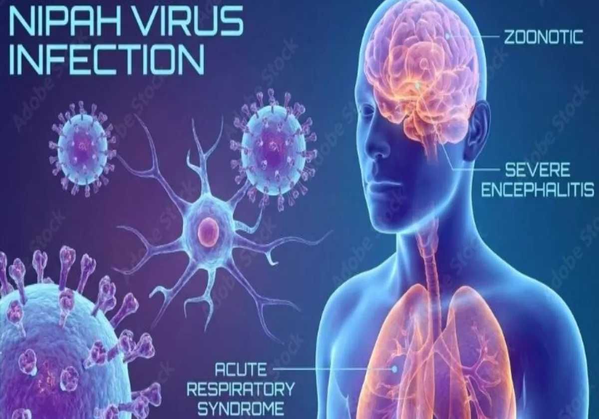 Cegah Penyebaran Virus Nipah, Singapura Perketat Skrining Bandara