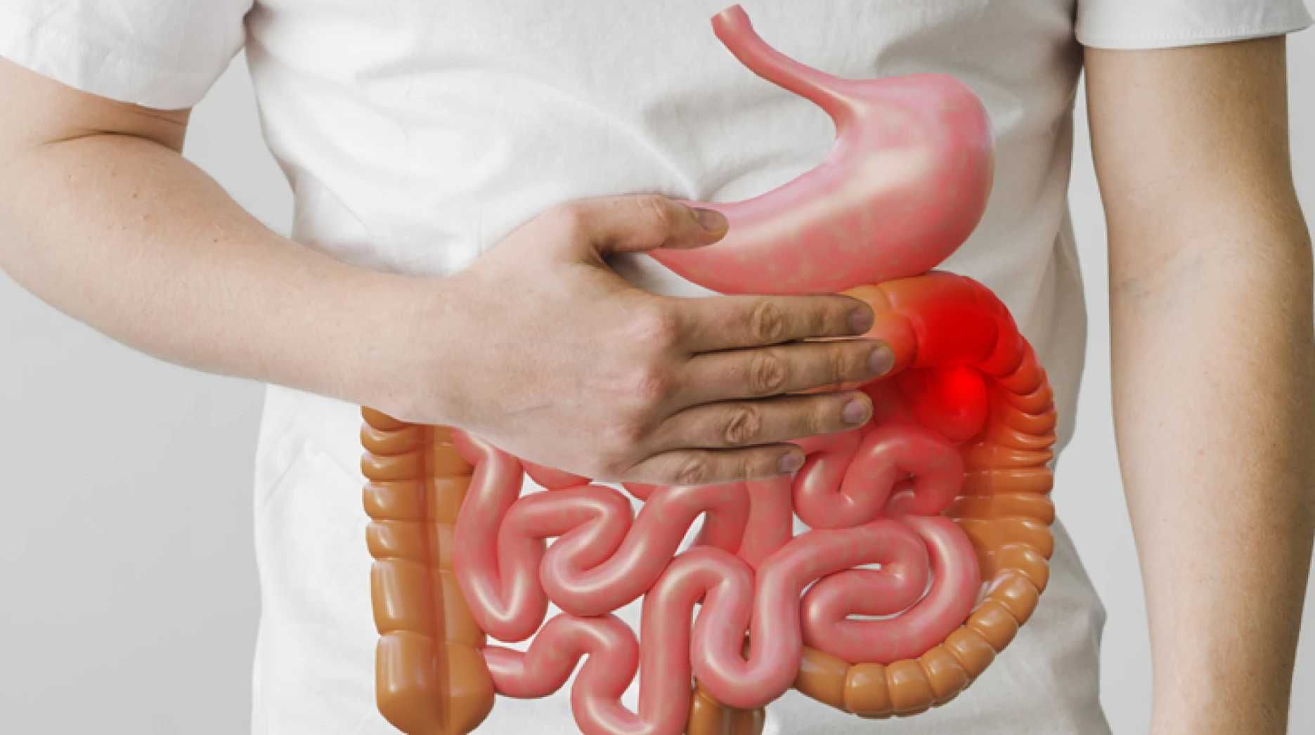 Studi: Lamanya Feses Tertahan di Dalam Usus Pengaruhi Kesehatan Seseorang